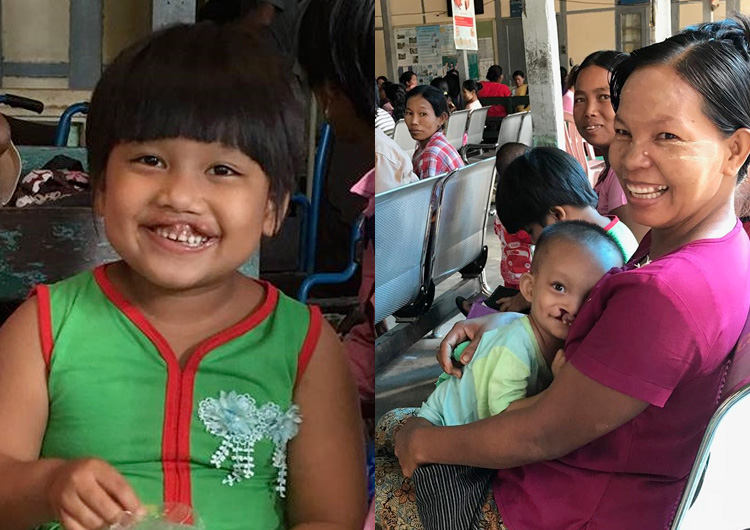 ジャパンハート 国際医療ボランティア ミャンマー活動レポート　口唇・口蓋裂手術ミッション