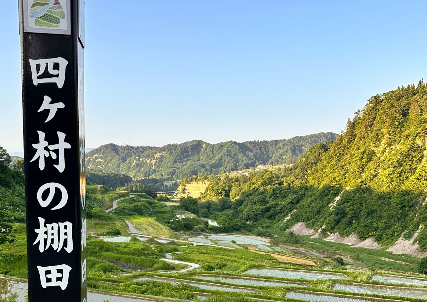 家族に寄り添う看護を考えた日々 ― 山形・新庄での半年間