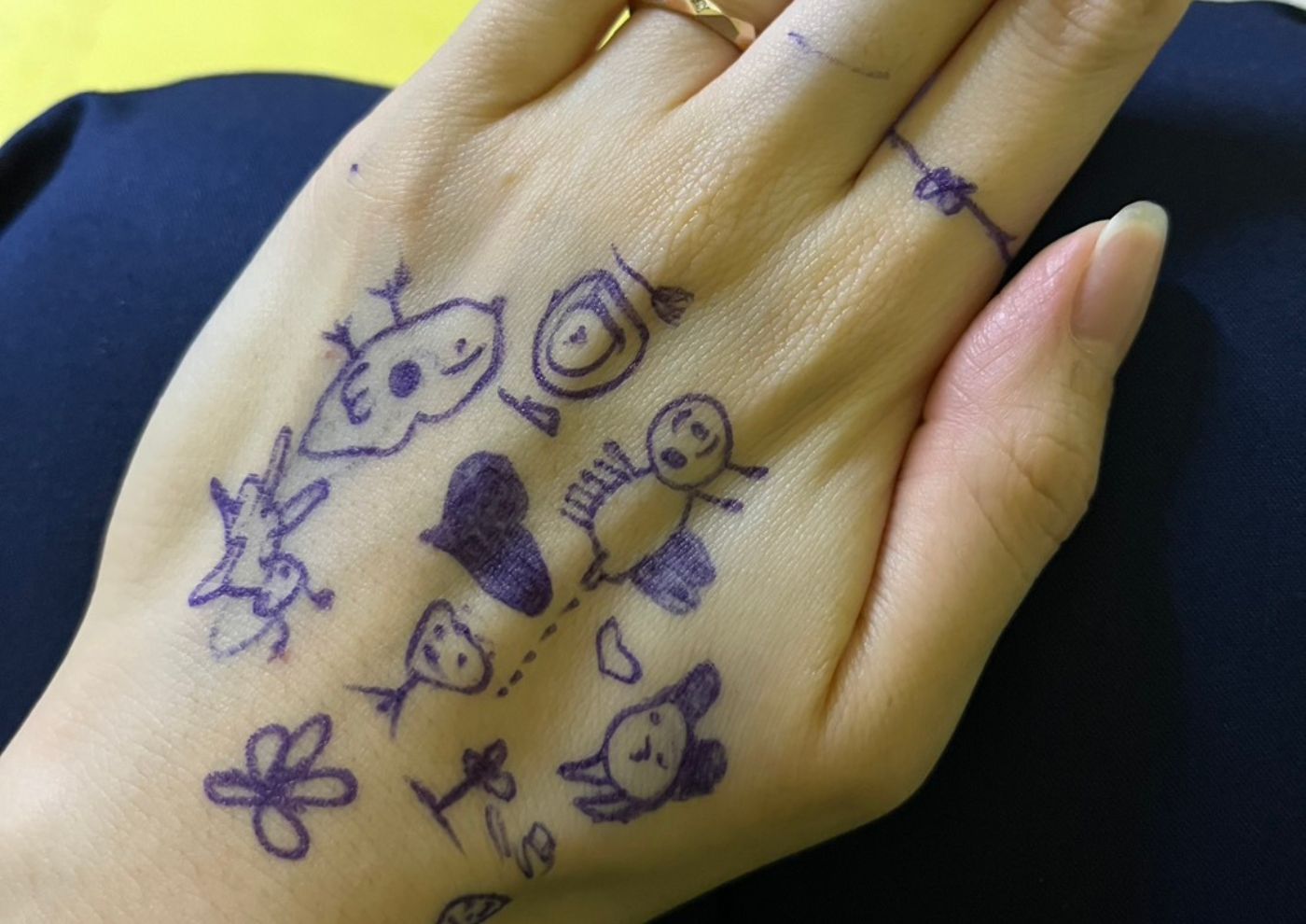 非医療者から見たジャパンハート子ども医療センター