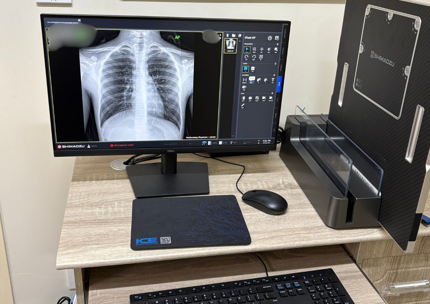 新病院 放射線科の立ち上げー診療放射線技師活動レポート③