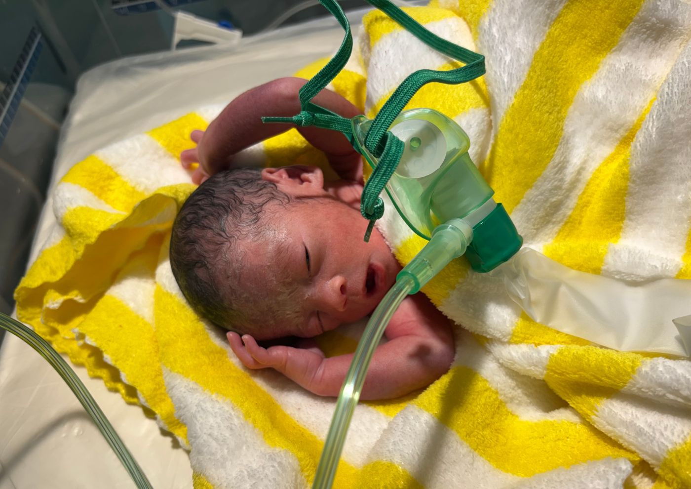 同じ26週、違う結末 ― 救えた命から考えたこと 